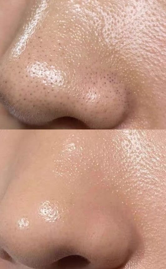 Nose - Rica Brazilian Wax